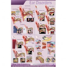 Blue Tree Ear Disorders P Poster (12&quot;W x 17&quot;H)