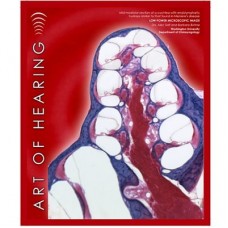 Art of Hearing Wall Art-Endolymphatic Hydrops (20x24)